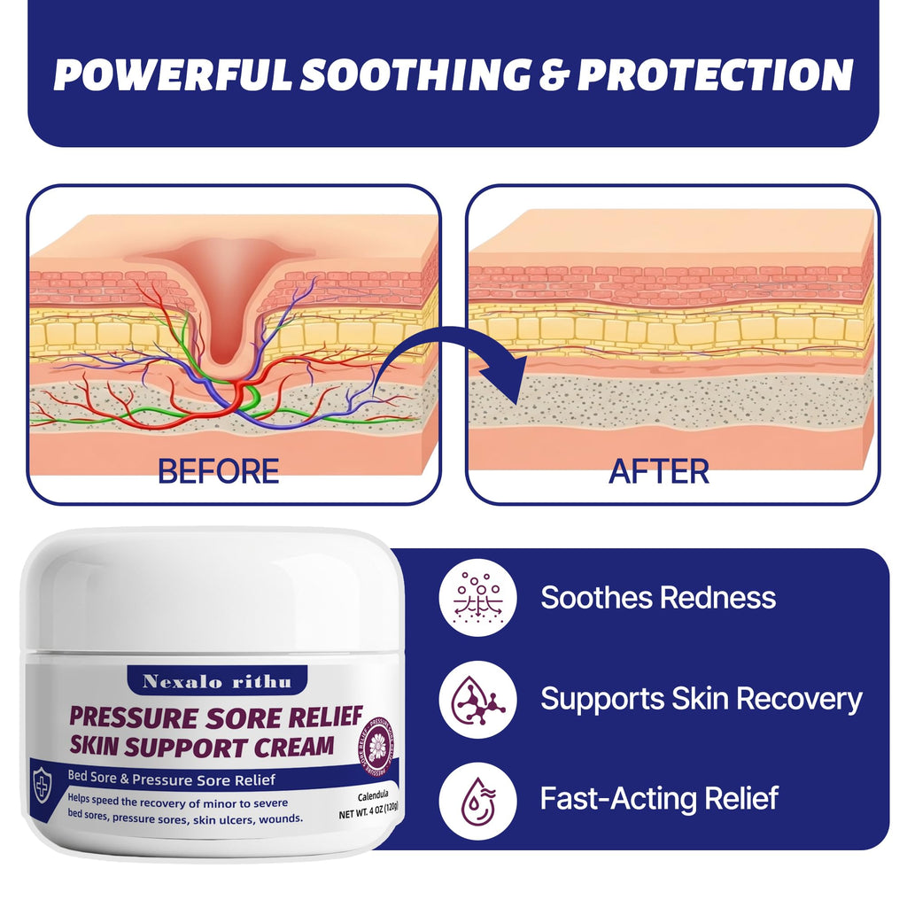 Calendula Aloe Vera Bed Sore Cream B10499