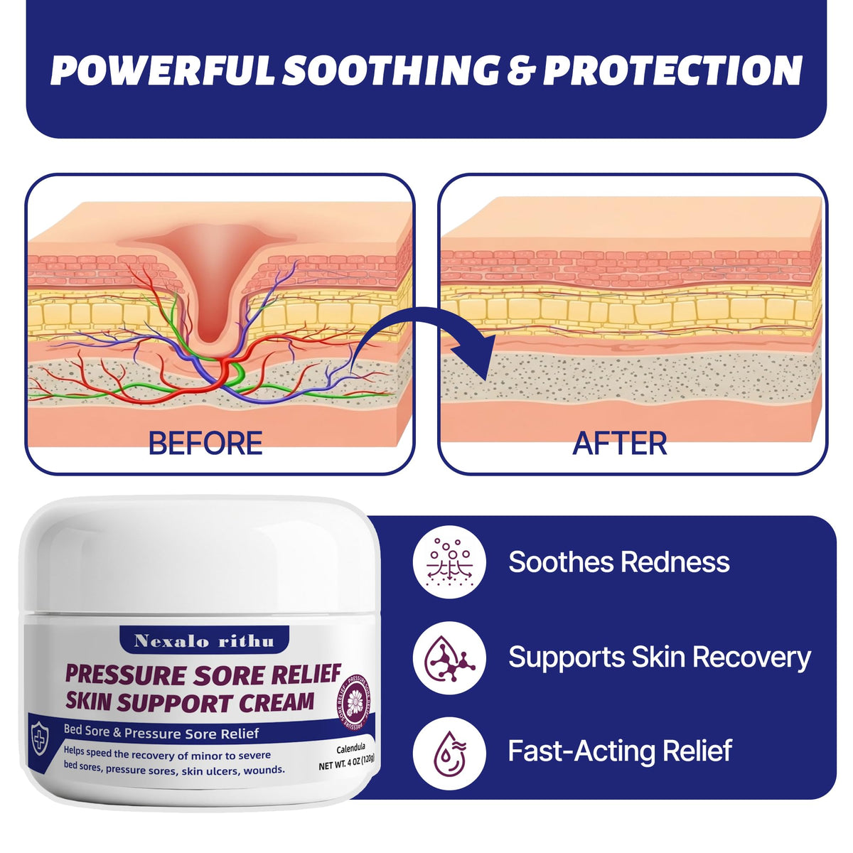 Calendula Aloe Vera Bed Sore Cream B10499